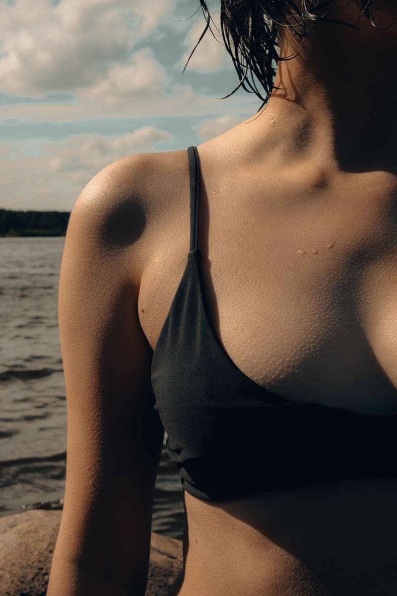 Breast Augmentation